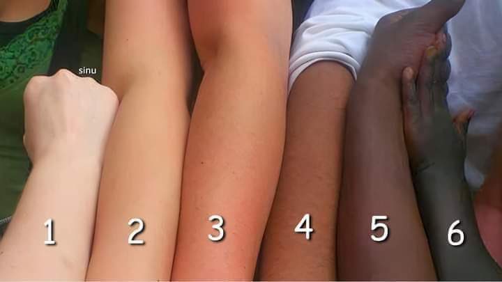 _SBET's tweet image. What's your skin tone?🤔