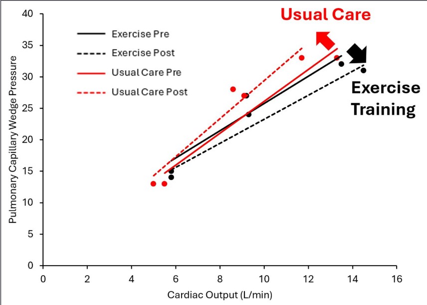 WEDGE-HCM #Editorial: Exercise improves cardiac hemodynamics in non-obstructive HCM, suggesting benefits like better LV compliance. A step forward for exercise as therapy @mpayers_md ahajournals.org/doi/full/10.11…