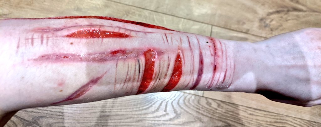 3PorridgeBears's tweet photo. Defo hit fascia, dunno how to feel tbh. I wish I took photos yesterday cause it looks so small now :/ https://t.co/RRd9OPA0fe