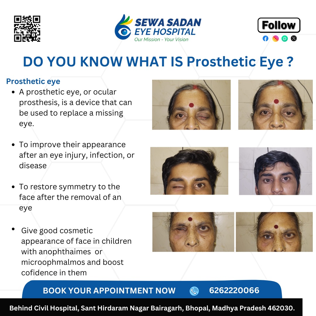 Sewa Sadan Eye Hospital Trust (@eye_sewasadan) on Twitter photo 