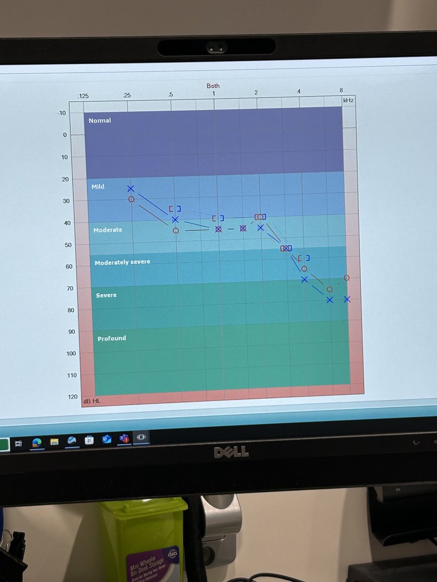 ⁦<a href="/dothinkeducate/">Anna</a>⁩ ⁦<a href="/WheatlandKim/">Kim from Ballina 🦐</a>⁩ I’m not deaf!!!! Much!!!🤦🏼‍♀️