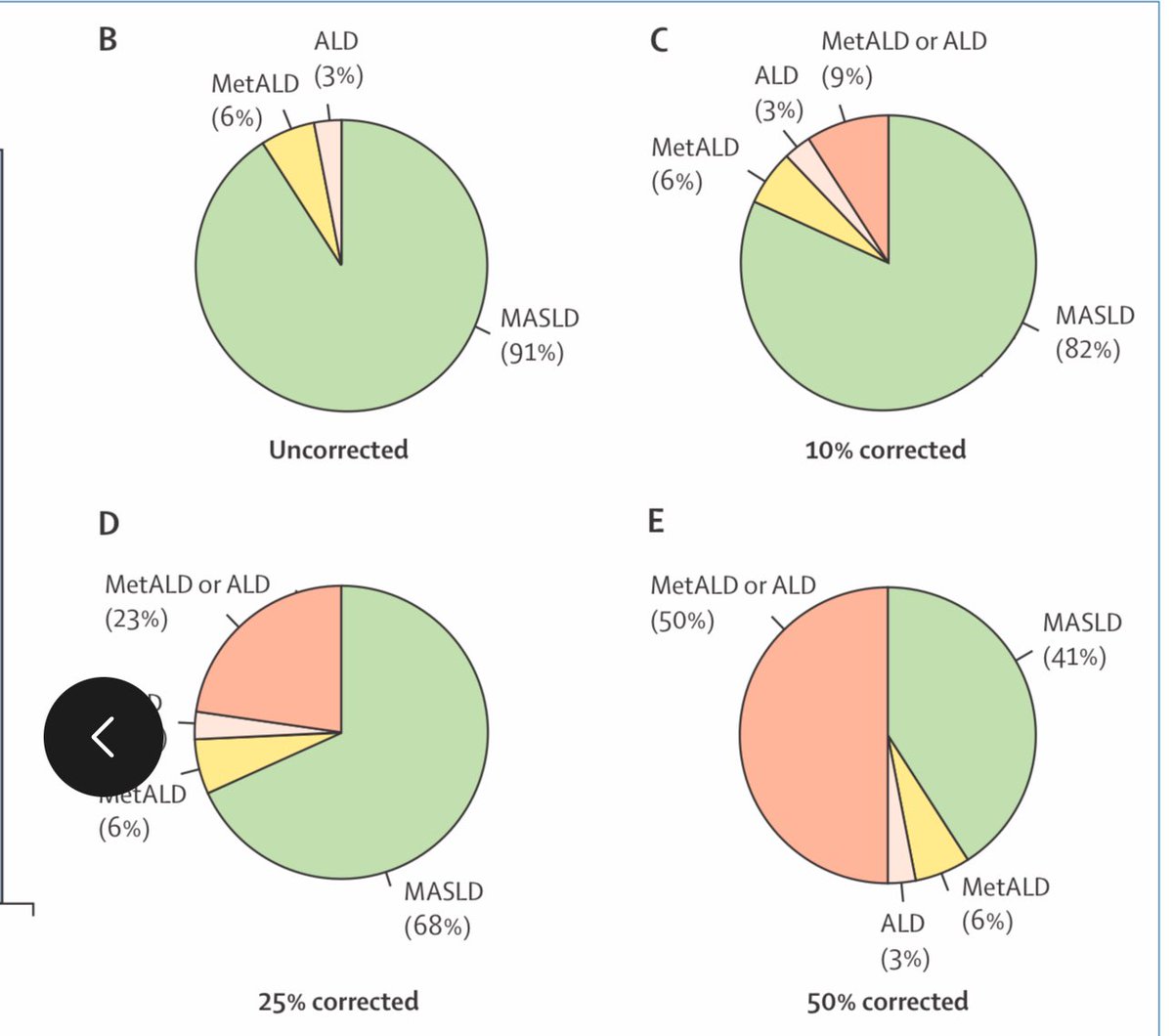Aleksander Krag (@aleksanderkrag) on Twitter photo Impact of under reporting of alcohol consumption in persons with Steatotic Liver Disease?
What is the true distribution of MASLD vs MetALD/ALD in the population ?
😳10-57% underreporting!
👉 currently 10:1 -wrong!
👉 1:1 more likely ?
<a href="/LancetGastroHep/">The Lancet Gastroenterology & Hepatology</a>
Link 🔗👇 Impact of under reporting of alcohol consumption in persons with Steatotic Liver Disease?
What is the true distribution of MASLD vs MetALD/ALD in the population ?
😳10-57% underreporting!
👉 currently 10:1 -wrong!
👉 1:1 more likely ?
<a href="/LancetGastroHep/">The Lancet Gastroenterology & Hepatology</a>
Link 🔗👇