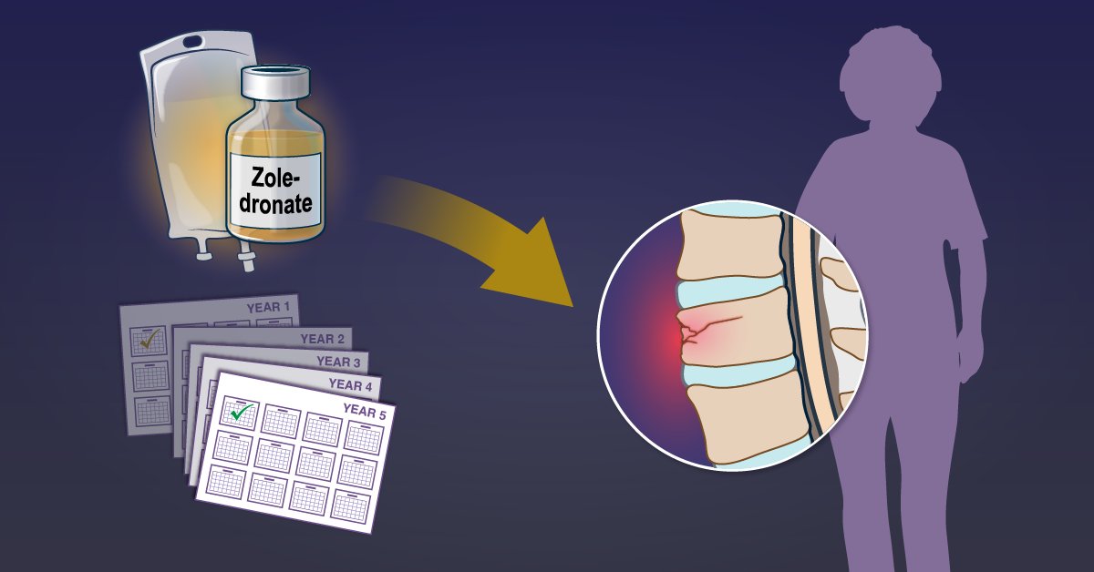 Zoledronate prevents fractures when given every 12 to 18 months, but its effects on bone health persist well beyond 5 years. Research findings on very infrequent zoledronate dosing in early postmenopausal women are summarized in a Quick Take video. nej.md/3C2CgHN