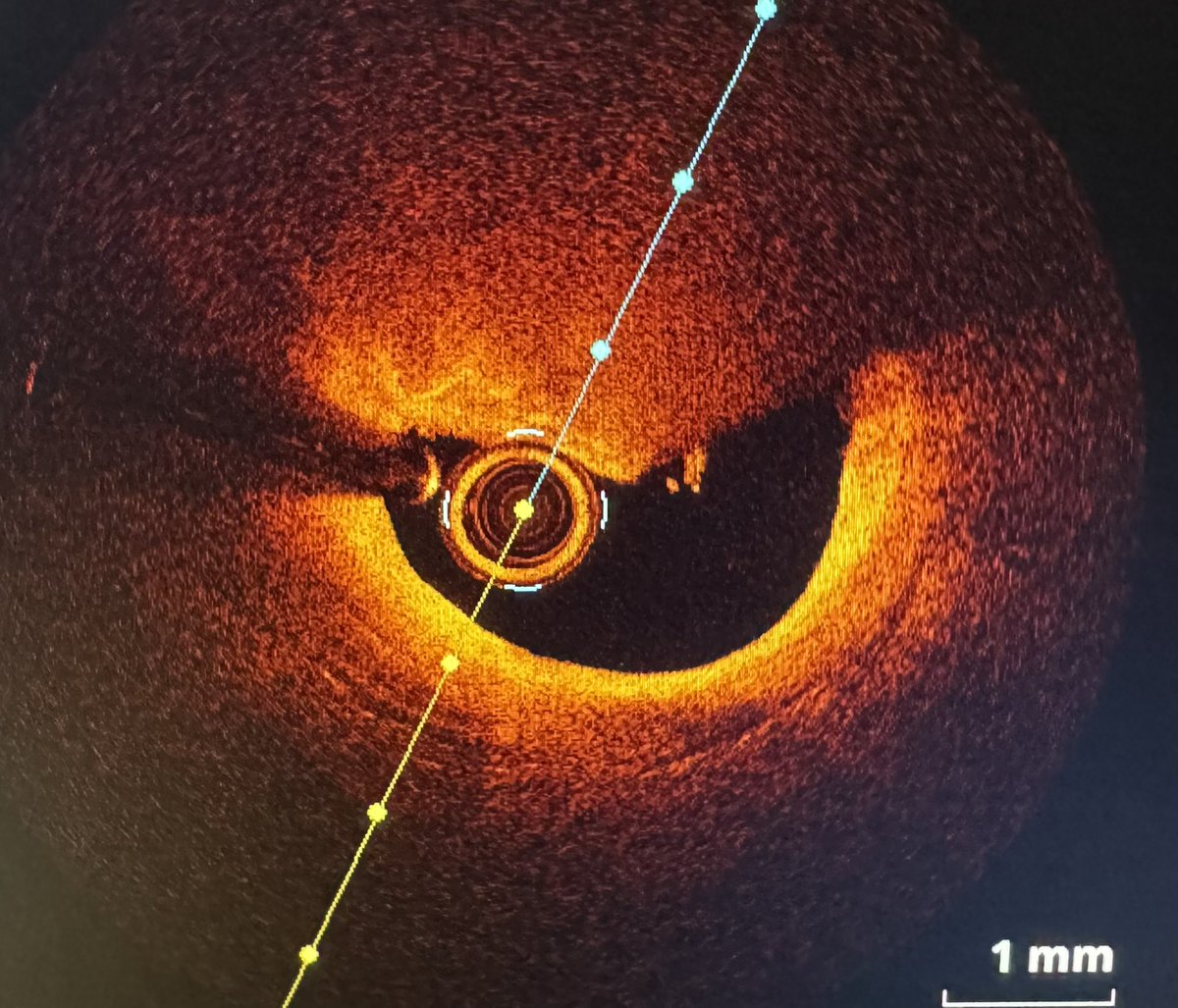Alfonso Jurado-Román tweet media