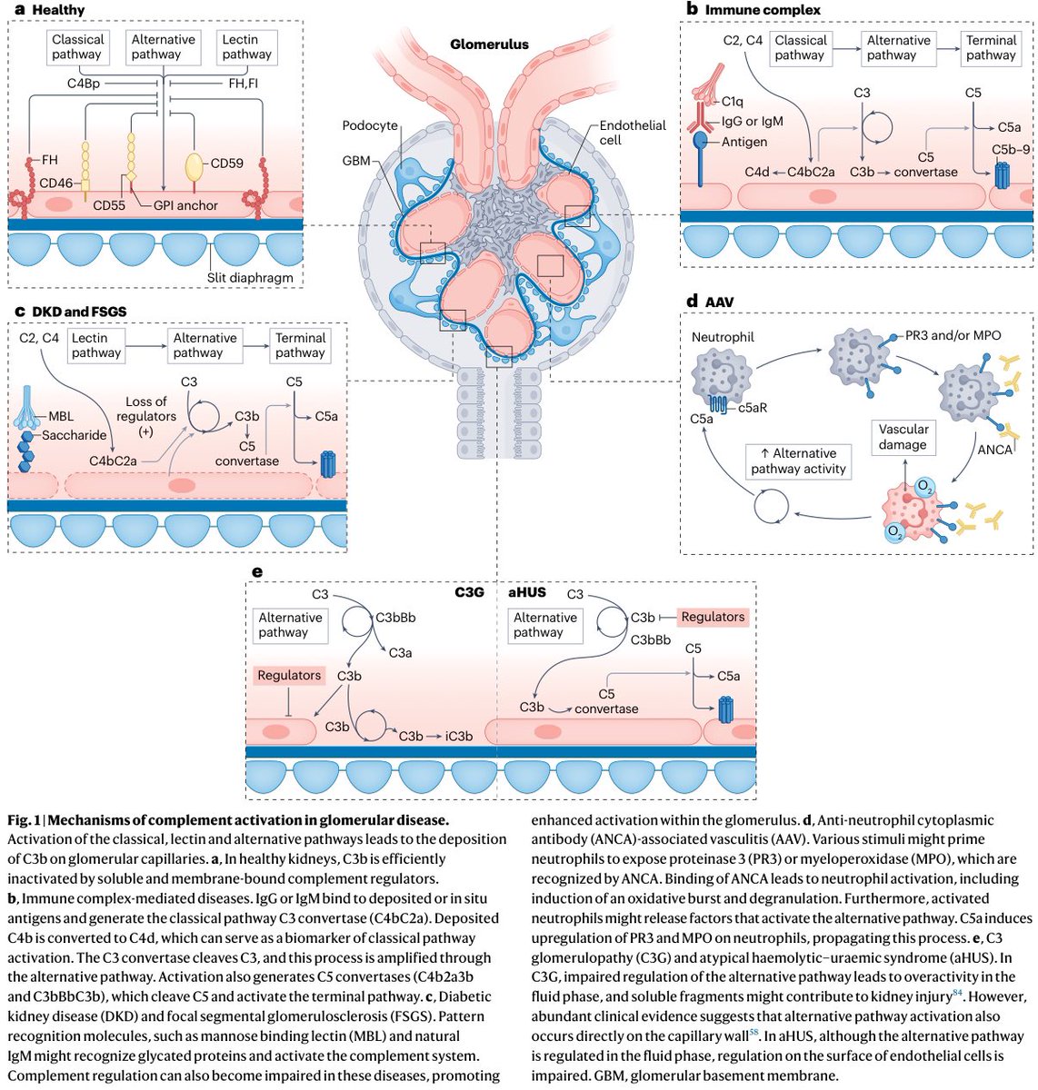 Trisha Laxamana MD π½π΅π (@nephrolotrish) on Twitter photo Presented a case of C3 Glomerulonephritis #C3GN for fellowβs case conference <a href="/NYUnephro/">NYU Nephrology</a> β¨
My favorite photos/diagrams from resources I used β highly educational!ππΌ
π kidney-international.org/article/S0085-β¦
π doi.org/10.1016/j.ekirβ¦
π doi.org/10.1038/s41581β¦
#glomerulardisease #nephrology Presented a case of C3 Glomerulonephritis #C3GN for fellowβs case conference <a href="/NYUnephro/">NYU Nephrology</a> β¨
My favorite photos/diagrams from resources I used β highly educational!ππΌ
π kidney-international.org/article/S0085-β¦
π doi.org/10.1016/j.ekirβ¦
π doi.org/10.1038/s41581β¦
#glomerulardisease #nephrology