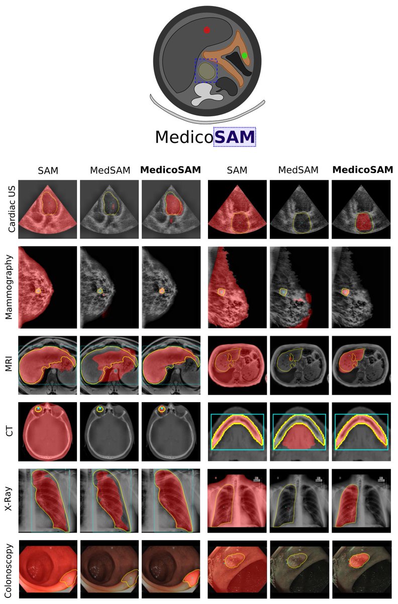 Constantin Pape (@cppape) on Twitter photo Our work, MedicoSAM, is now on arXiv! We study finetuning SAM for medical images. MedicoSAM improves over SAM and other models, especially for interactive segmentation, see examples in the figure. Preprint at arxiv.org/abs/2501.11734. Read on for a summary.
<a href="/AnwaiArchit/">Anwai Archit</a> Our work, MedicoSAM, is now on arXiv! We study finetuning SAM for medical images. MedicoSAM improves over SAM and other models, especially for interactive segmentation, see examples in the figure. Preprint at arxiv.org/abs/2501.11734. Read on for a summary.
<a href="/AnwaiArchit/">Anwai Archit</a>