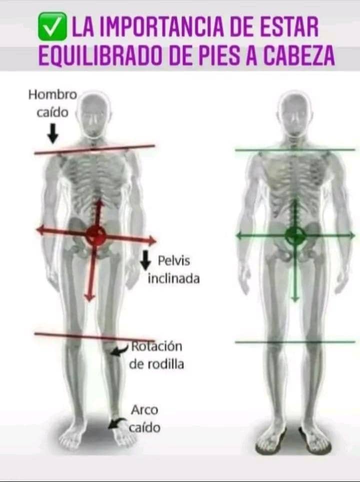 Renacerspaven's tweet photo. No te permitas estar así 😵😱🫣🫢🤷‍♂️. 
Pide tu cita ya 🏃🏃‍♀💨
Llama 📲 0424-9038386
José Fuentes 🙌 
Quiropraxia y Osteopatia
Afectaciones: Cervicales, dorsales y lumbares, escoliosis, fibromialgia, nervio ciático, entre otras. 
Cupos limitados https://t.co/B0ZCbX23vi