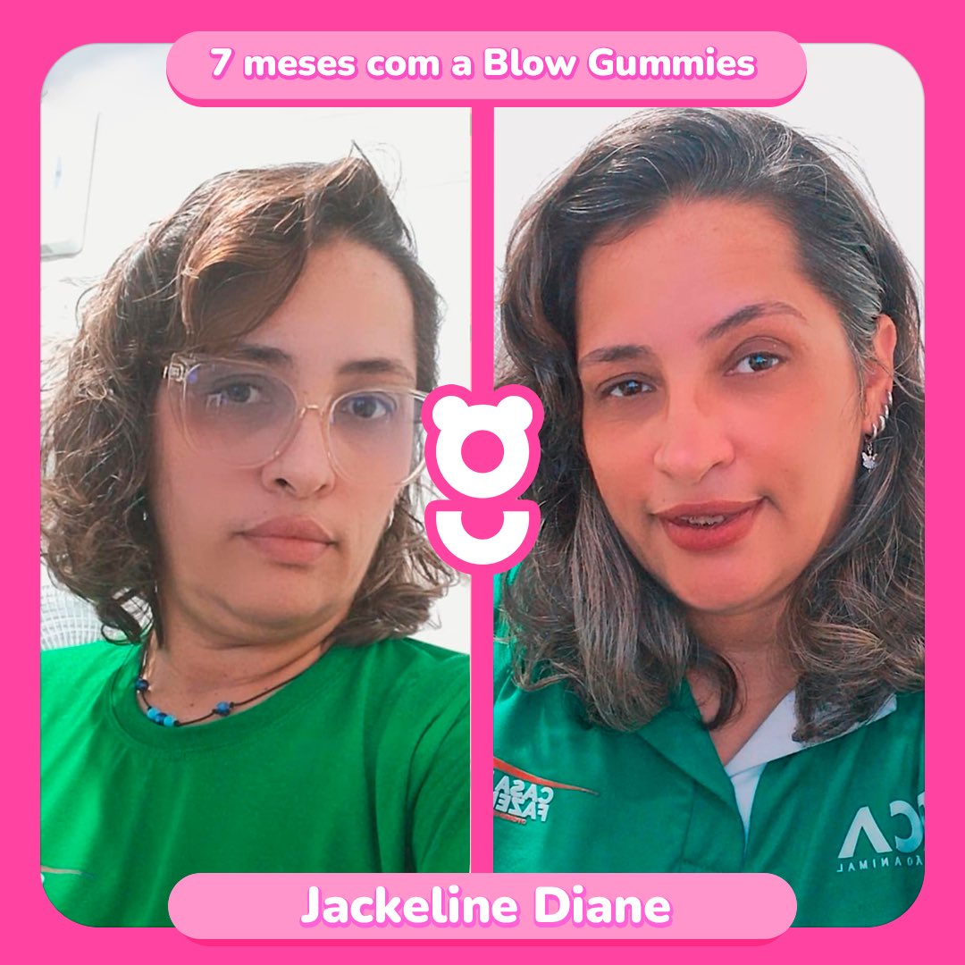 BlowGummies's tweet photo. Quem aí concorda que o cabelão da Jacke turbinou por causa da Blow Gummies? ✅

Se liga no relato dela:

"Minha experiência tem sido maravilhosa! Conheçi a blow gummies através de uma amiga e estou amando e super indico. 😍" https://t.co/fH3PUPdy7w