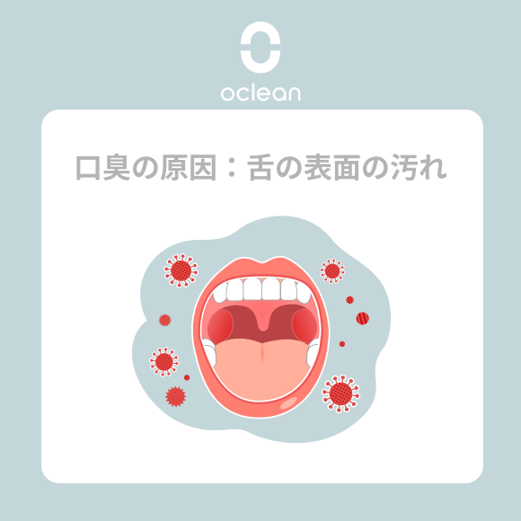 Oclean_JP's tweet photo. ＜口臭の原因3⃣：舌表面の汚れ＞

😛舌に食べかすや細菌が溜まると、特に舌の奥で口臭が発生することがあります🙊。

対策🙌：
❶歯磨き後、舌クリーナーや柔らかい歯ブラシで舌苔にたまった細菌や残留物をしっかり取り除きます。
❷抗菌成分が含まれたマウスウォッシュを使用して、口臭を予防しましょう。

Oclean電動歯ブラシ専用ブラシヘッドには、裏面に舌苔クリーナーが付いています！
製品詳細はこちら↓↓
https://t.co/6EjCklEr8j

#口臭対策 #口腔健康 #口腔ケア ＃オーラルケア ＃歯周病 ＃電動歯ブラシ