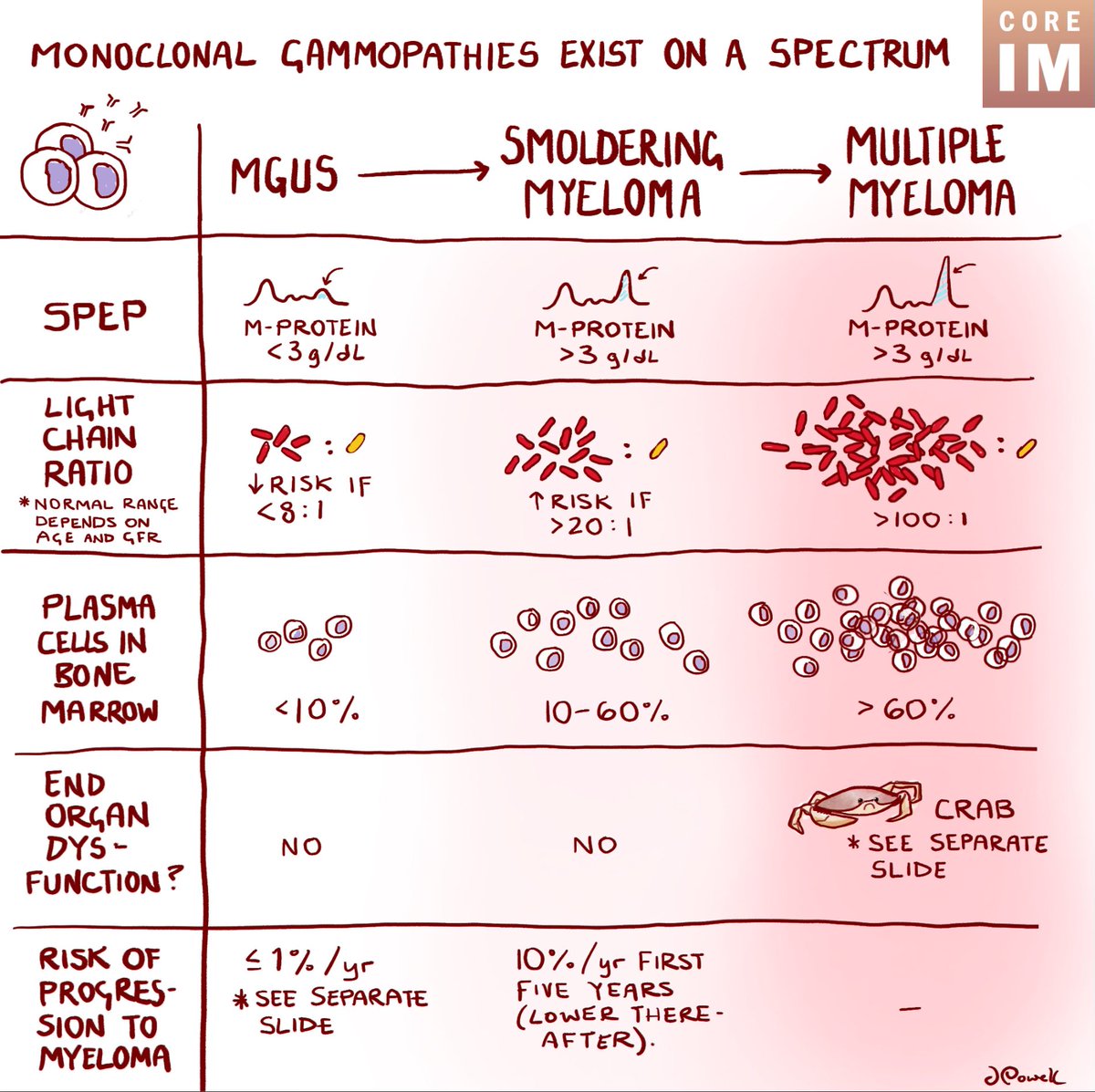 1/ 🚨 NEW #5Pearls: MGUS to Multiple Myeloma Diagnostics and Counseling

Monoclonal gammopathies:
🔬A spectrum of severity from MGUS to SMM to MM

🖥️: coreimpodcast.com/2025/01/22/mon…
Sponsor: @FreedMedicalAI