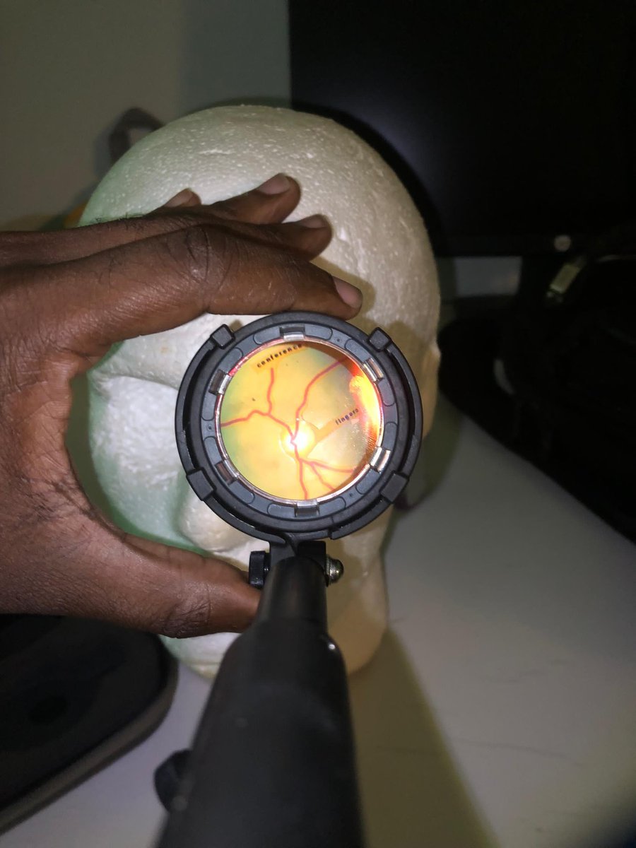 justbedebonair's tweet image. Was the subject of a fundoscopy sesh today.....it was fun. 
Here's my retina. 

#optometry #optometrystudent #fundoscopy #fundusimaging