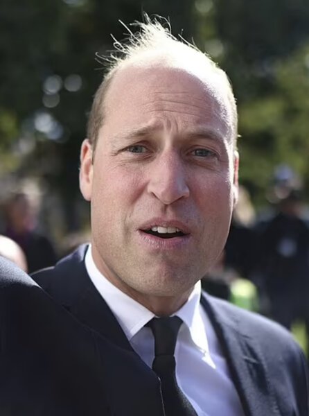 William took 1 million to shut his mouth.

Harry got between 10 and 20 million, a public apology and The Sun admitting their wrongdoings.