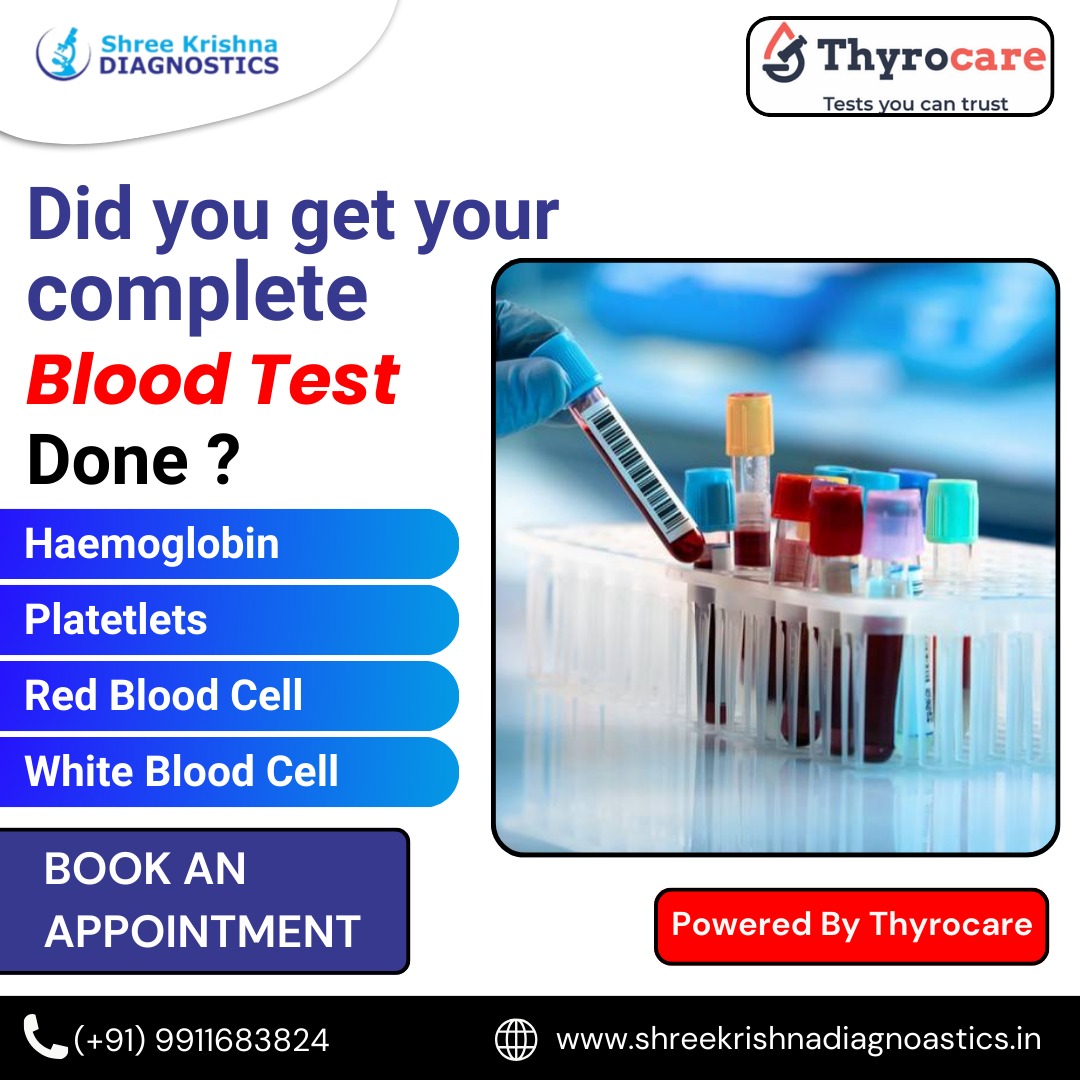 Shree Krishna Diagnostic-Thyrocare Lab tweet media