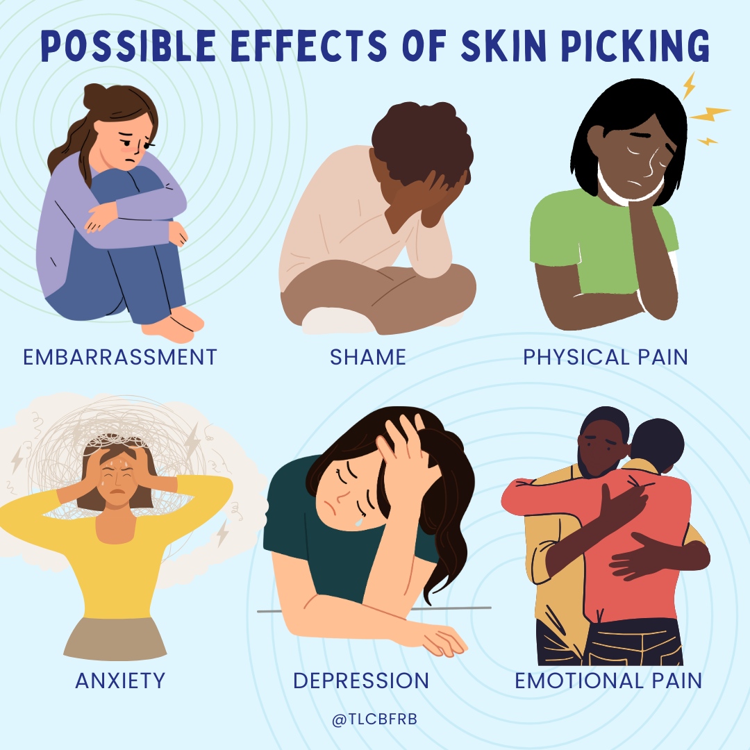 tlcBFRB's tweet photo. In addition to feeling shame and embarrassment, people with skin picking disorder may have other psychological problems like depression and anxiety.

Visit our website at https://t.co/foTosmGG8g for more information on how we can support you. 💚 https://t.co/v3rZkHuNYa