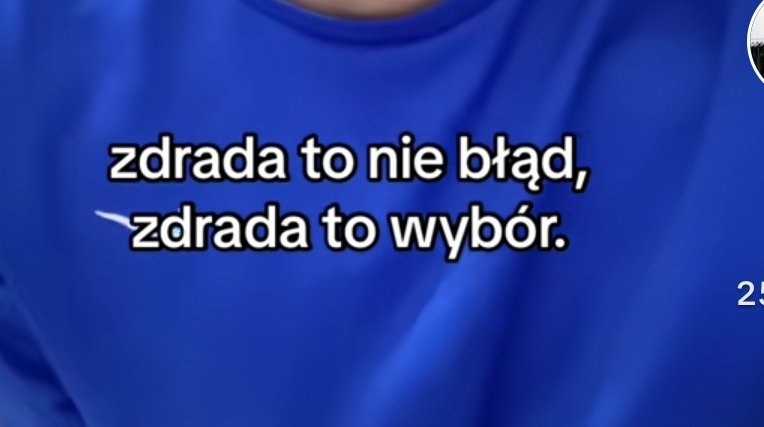 rudaa_19's tweet photo. Nikt mi nigdy nie wmówi, że jest inaczej https://t.co/xlgISstxgZ