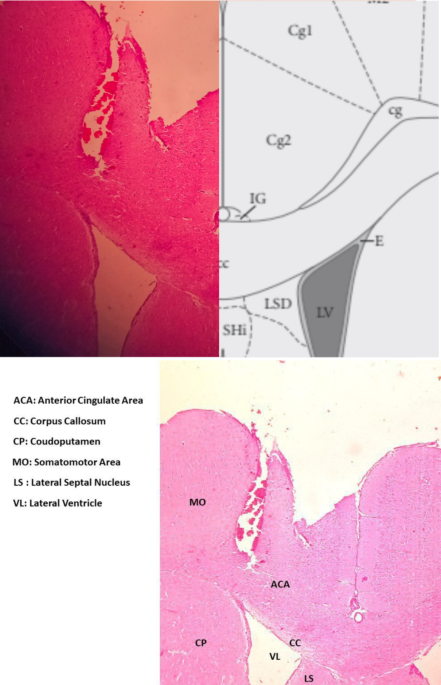 thebraindriver's tweet image. Deep #BrainStimulation of the anterior cingulate cortex reduces #OpioidAddiction Scientific Reports @nature @TheBrainDriver #tDCS #BrainStimulation #HolisticHealth #Naturopathy #addiction #opioduse
nature.com/articles/s4159…