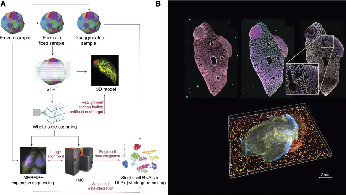 Cancer Discovery (@cd_aacr) on Twitter photo In Focus: Cancer Research in the Age of Spatial Omics: Lessons from IMAXT brnw.ch/21wQaVB
By Dario Bressan, IMAXT Cancer Grand Challenges Consortium, Nicholas Walton, and Gregory Hannon <a href="/CR_UK/">Cancer Research UK</a> <a href="/CRUK_CI/">CRUK Cambridge Institute</a> <a href="/CancerGrand/">Cancer Grand Challenges</a> In Focus: Cancer Research in the Age of Spatial Omics: Lessons from IMAXT brnw.ch/21wQaVB
By Dario Bressan, IMAXT Cancer Grand Challenges Consortium, Nicholas Walton, and Gregory Hannon <a href="/CR_UK/">Cancer Research UK</a> <a href="/CRUK_CI/">CRUK Cambridge Institute</a> <a href="/CancerGrand/">Cancer Grand Challenges</a>