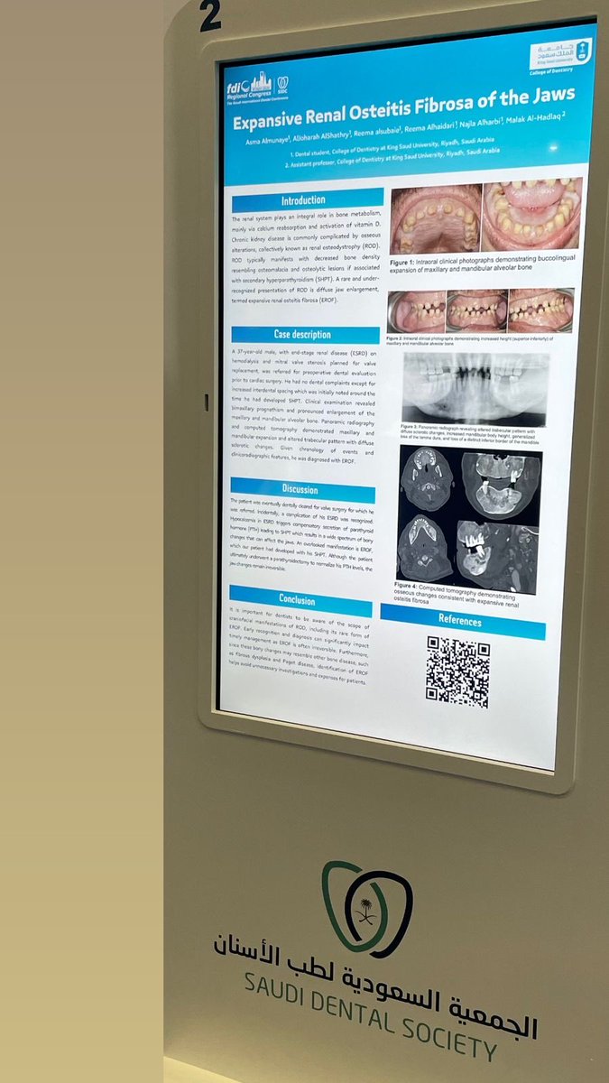 انجاز مشرّف نفخر به ⁦<a href="/ksudental/">كلية طب الأسنان</a>⁩ طالباتنا ⁦<a href="/DrReemaals/">ريـما السبيعي</a>⁩ ⁦<a href="/Asma_space/">Asma</a>⁩ <a href="/ReemaKH22/">Reema</a> <a href="/J_AlShathry/">AlJoharah AlShathry</a> <a href="/nnajla01/">Najla Alharbi</a> حازوا على المركز الاول Clinical Case Presentation Awards في مؤتمر سيدك ⁦<a href="/DentalSaudi/">Saudi Dental Societyالجمعية السعودية لطب الأسنان</a>⁩ بإشراف د. ملاك الهدلق ⁦<a href="/malak_alhadlaq/">Malak</a>⁩
