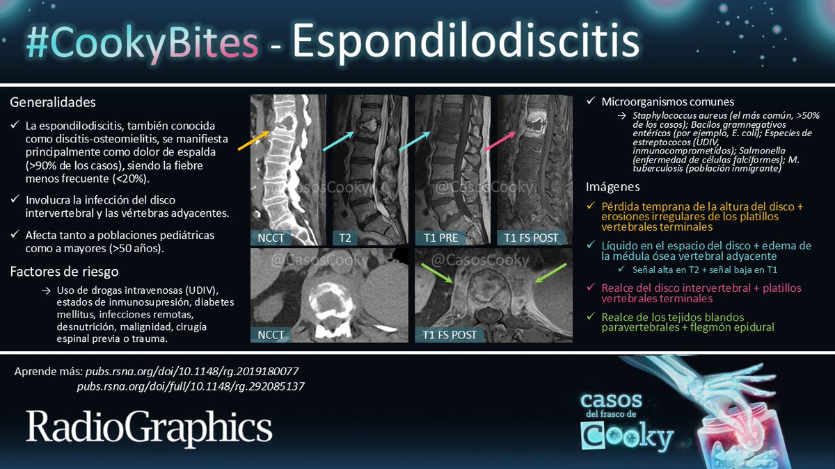 Casos de Cooky (@casoscooky) on Twitter photo Respuesta: Espondilodiscitis
Aprende más:
pubs.rsna.org/doi/10.1148/rg…
pubs.rsna.org/doi/full/10.11…
Traducido por: <a href="/MariaLuciaBrunV/">MaríaLucía Brun-Vergara</a>
#CasosCooky #CookyBites #154 #RGphx <a href="/cookyscan1/">Cooky Menias</a> <a href="/RadioGraphics/">RadioGraphics</a> Respuesta: Espondilodiscitis
Aprende más:
pubs.rsna.org/doi/10.1148/rg…
pubs.rsna.org/doi/full/10.11…
Traducido por: <a href="/MariaLuciaBrunV/">MaríaLucía Brun-Vergara</a>
#CasosCooky #CookyBites #154 #RGphx <a href="/cookyscan1/">Cooky Menias</a> <a href="/RadioGraphics/">RadioGraphics</a>