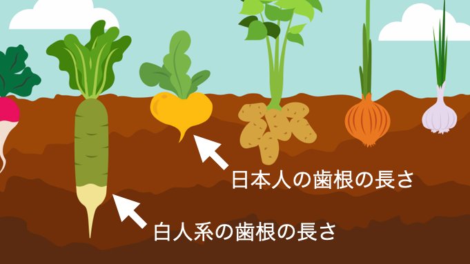 shira_ortho's tweet photo. 日本人は叢生が多いだけではありません。
歯根の長さには人種によって差があり、白人系と比較すると日本人の歯根は特に短いです。
そして歯槽骨も薄いです。
例えるなら白人系の歯根は畑に深く根を生やしている作物で、日本人の歯根は浅く畑に根を生やしている作物のようなものです。 https://t.co/tTdCvmXTV2