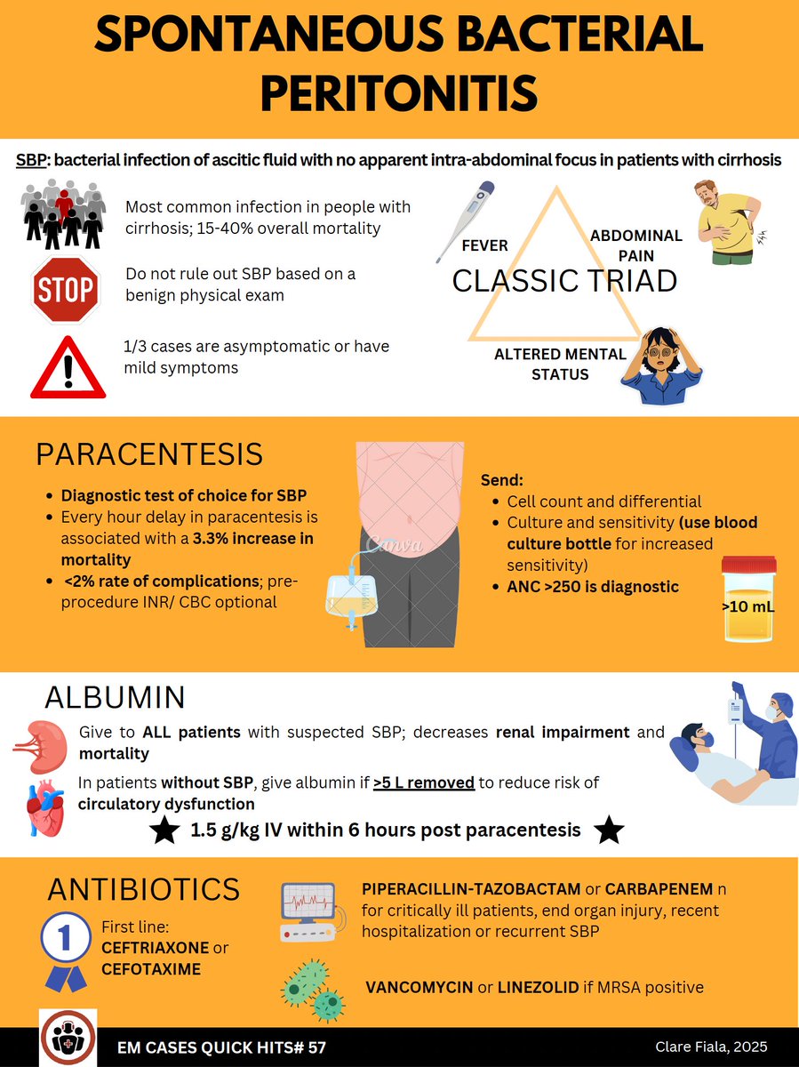 Our infographic on Spontaneous Bacterial Peritonitis based on EM Quick Hits 57 emergencymedicinecases.com/em-quick-hits-…