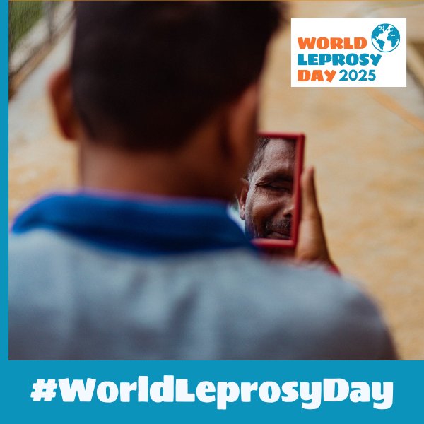 For 3-4 million people living with visible impairments due to leprosy, self-care 🩹 is crucial. Through self-care, we can stop visible impairments to 🦶👁️ 👐 before they start.
#WorldLeprosyDay #UniteActEliminateLeprosy #ActNow