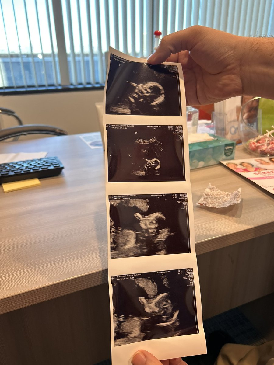 Friends and family i have big news 

Due june 28th the week after my bday
Im so excited! 
Will know gender next month ❤️❤️❤️