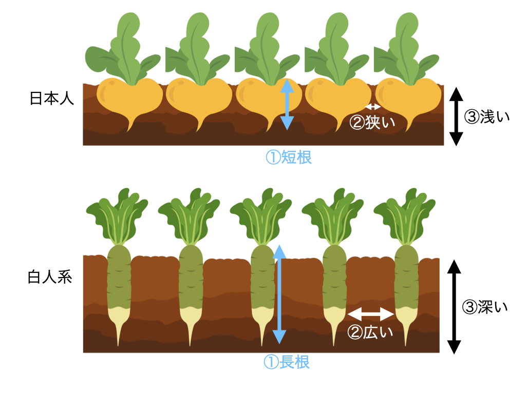 shira_ortho's tweet photo. 日本人の歯と歯槽骨は
①短根
②根間距離が狭くて骨量が少ない
③歯槽骨が浅い
なので白人系より歯が長持ちしにくいです。
だから白人系のマネした矯正ではなく、日本人向けの力の優しいライトフォースな矯正が向いているわけです。 https://t.co/WQEdSa0hKx