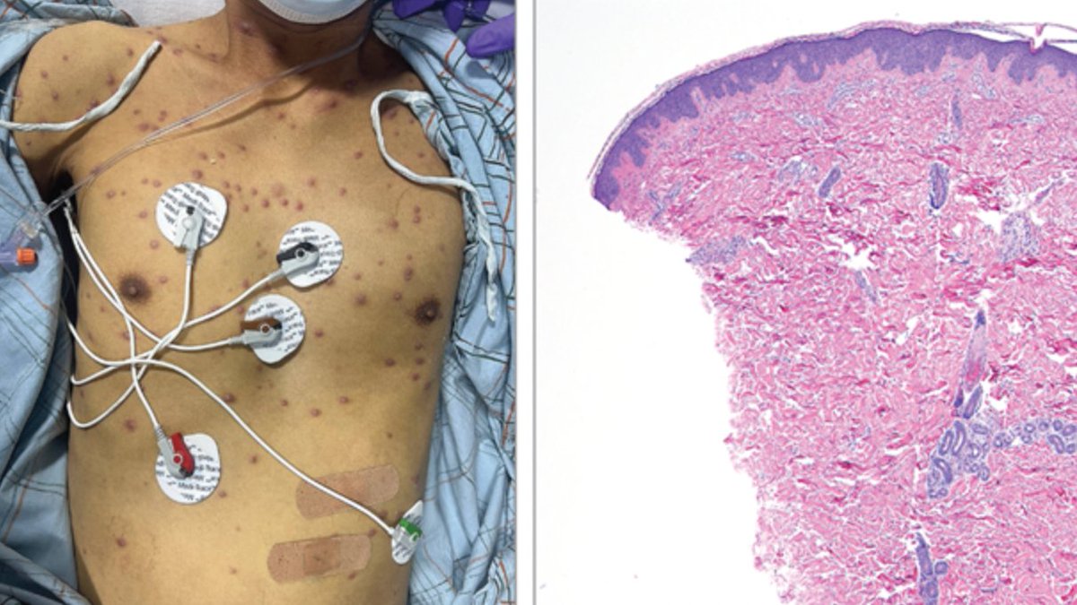 Christine J. Ko, MD tweet media