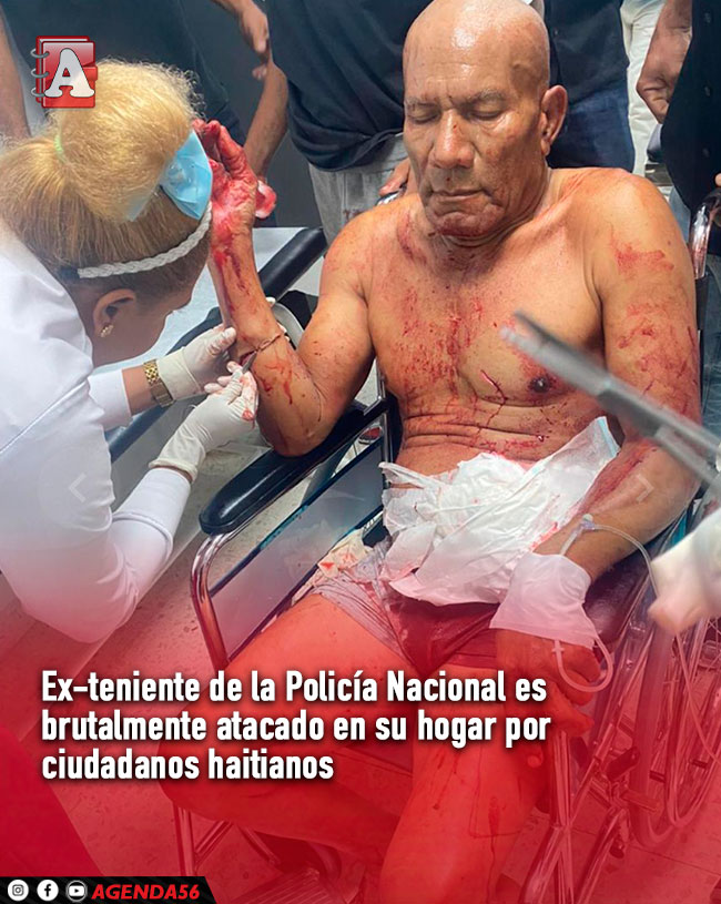 rafaelgil251051's tweet photo. Galván, provincia Bahoruco, el ex-teniente de la Policía  Félix Mejía Santana, alias “Ayul”, fue víctima de un  asalto en su propia vivienda
 varios  haitianos irrumpieron en la residencia del ex-oficial, y lo atacaron en múltiples ocasiones, causándole heridas de Gravedad. https://t.co/Odw1pS9yGk