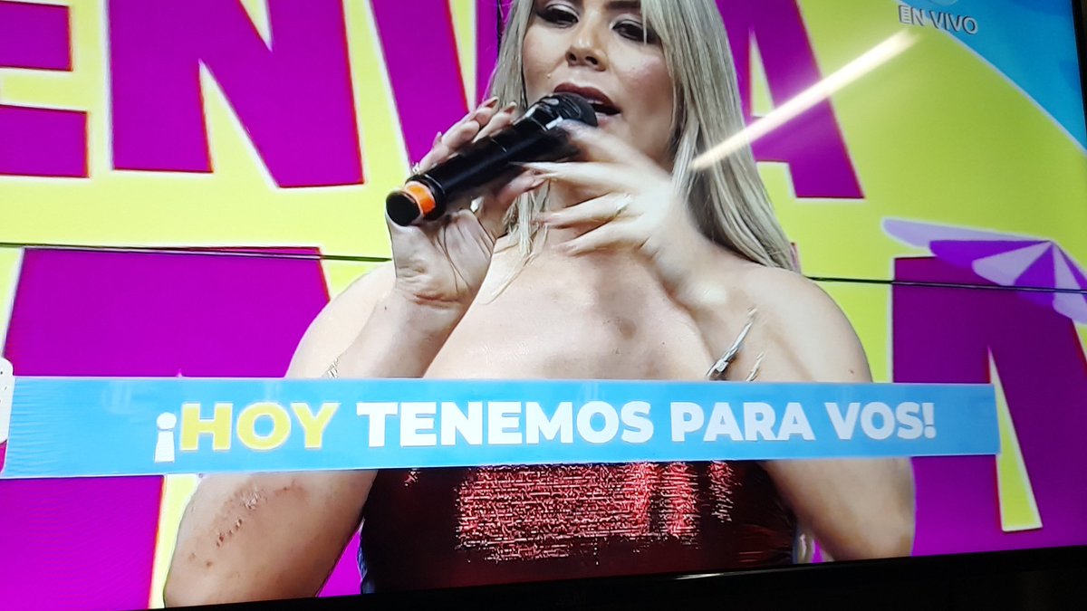 Qué le pasó a #SoleCardozo en su brazo derecho??? Parece que se raspó todito mal 🤔