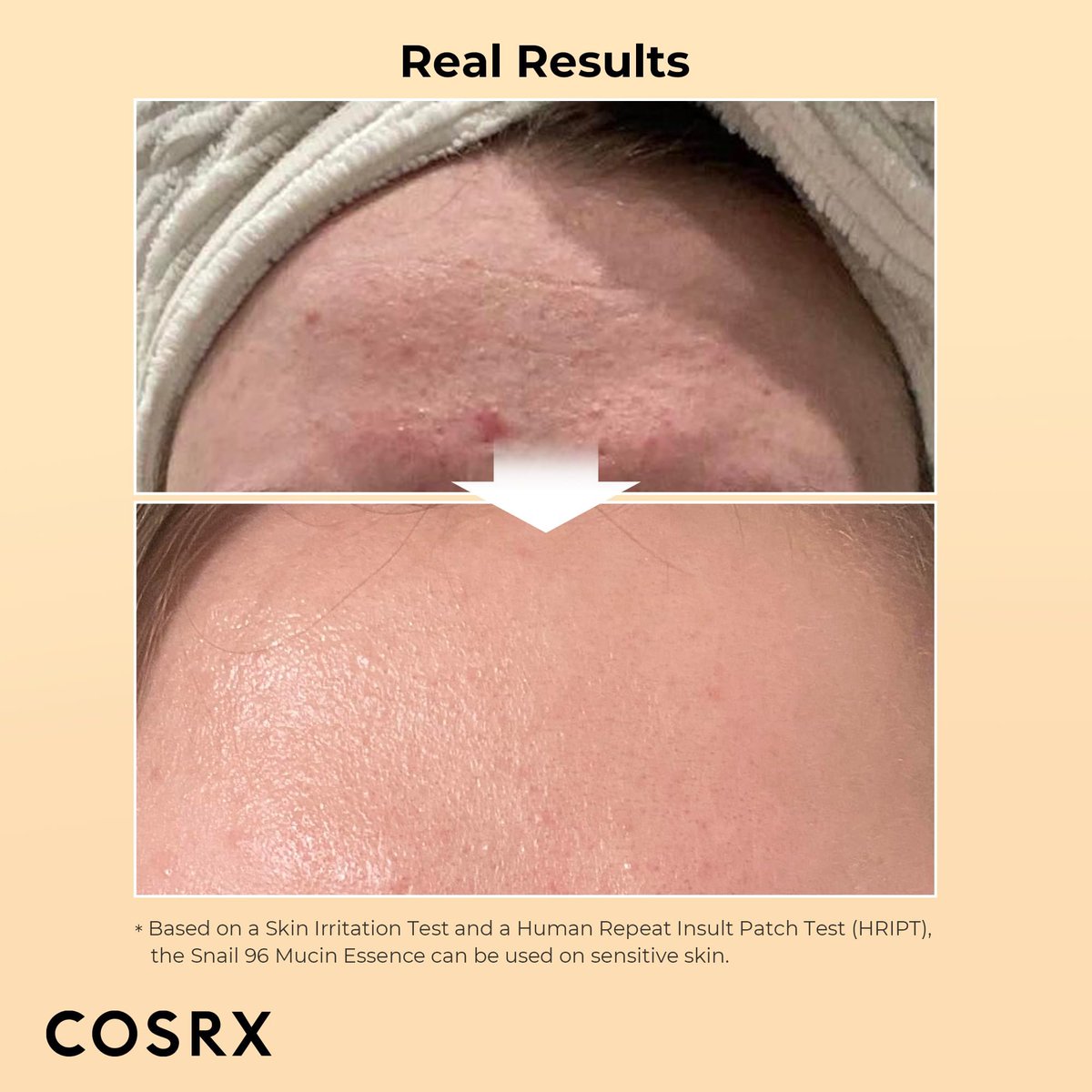 MNiceties's tweet photo. 🌟COSRX ADVANCED SNAIL POWER ESSENCE 
Soothe damaged skin and repair dark spots

🌟PRICE: 100k
🌟SIZE: 100ml
📱Call/WhatsApp 0755232119 to order for delivery. 
✨FREE DELIVERY FOR ORDERS ABOVE 100k. https://t.co/0c5Zapf3uA