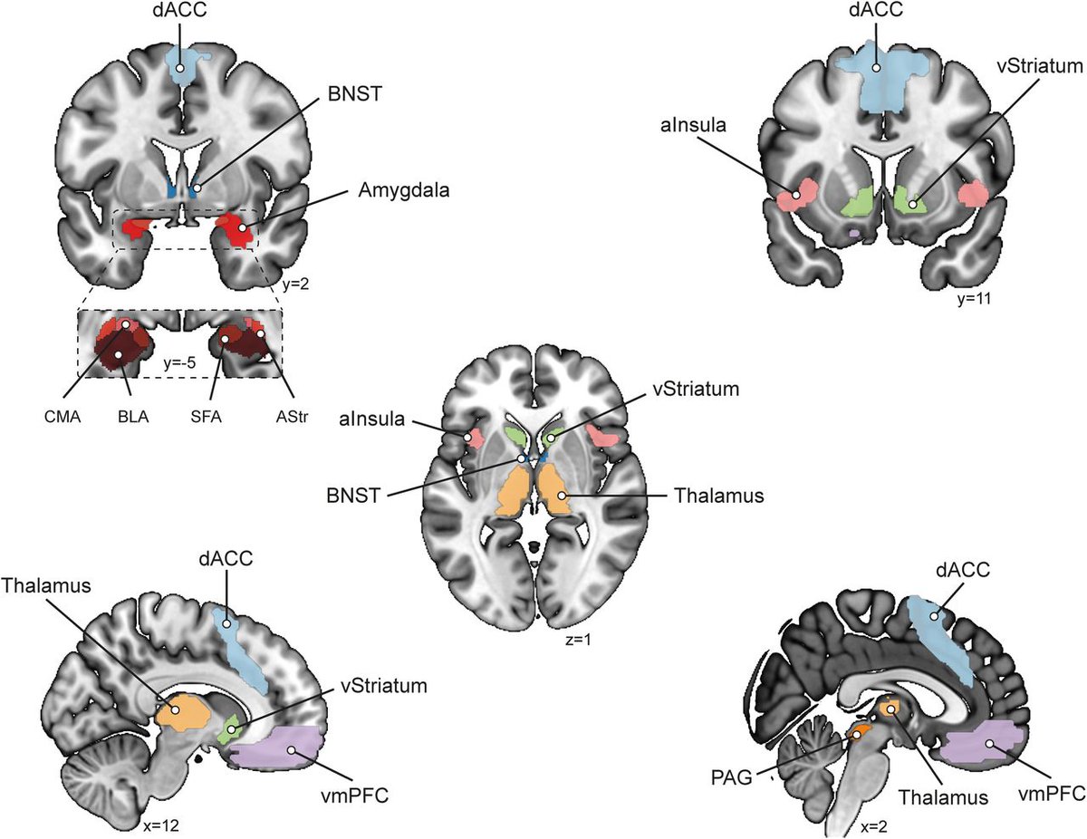 SfN Journals (@sfnjournals) on Twitter photo #JNeurosci: Findings from <a href="/anneloeshulsman/">Anneloes Hulsman</a> @FelixKlaassen @devoogd_l <a href="/EPAN_lab/">Karin Roelofs</a>, and Klumpers enhance our understanding of approach-avoidance decision-making by challenging traditional views of brain regions as primarily reward- or threat-sensitive and offering a more nuanced #JNeurosci: Findings from <a href="/anneloeshulsman/">Anneloes Hulsman</a> @FelixKlaassen @devoogd_l <a href="/EPAN_lab/">Karin Roelofs</a>, and Klumpers enhance our understanding of approach-avoidance decision-making by challenging traditional views of brain regions as primarily reward- or threat-sensitive and offering a more nuanced