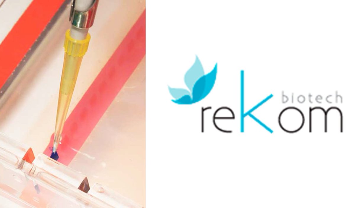 tfs_glocal's tweet photo. UPDATE! Rekom Biotech.
Chimeras: Multi-epitope Biomarkers

Rekom offers raw materials for IVD and allergens.

https://t.co/fdlKzgVRJ2

#invitrodiagnostic #TokyoFutureStyle #RekomBiotech https://t.co/mFXgCT7CBt
