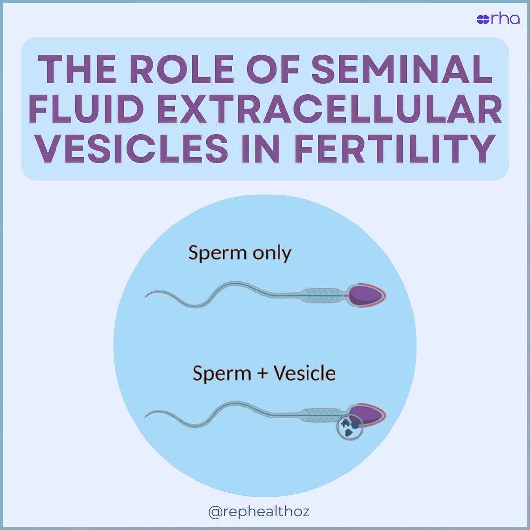 RepHealthOz's tweet photo. 💡 Aussie researchers have been exploring how seminal fluid extracellular vesicles (SFEVs), influence #sperm function and #fertilisation potential.
✨ Analysis revealed changes in #spermmotility, however SFEVs did not significantly affect #spermcapacitation. https://t.co/Dbqyv86r1e