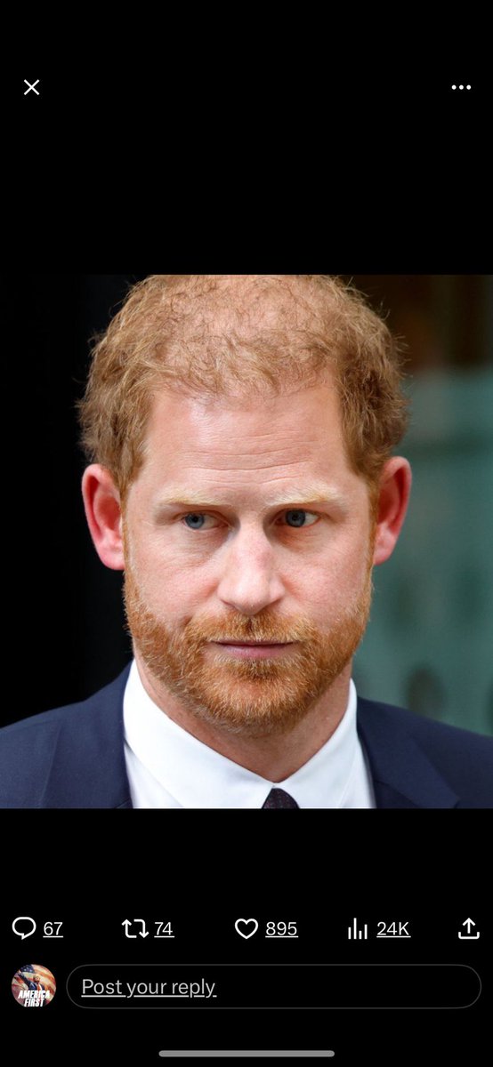 0Rthebest91033's tweet photo. #HarryWillAlwayBeNumber2 π©π€‘
#DisasterTouristsMeghanAndHarry #DonutDonAKAPrinceHarry #DisingenuousEntitledPeopleInTheWorld #DukeOfShameAndHypocrisy #StrippedTitlesAwayFromHarryAndMeghan #SussexsShitShow #ShitShowInMontecito #DimWitHarryNeeds2BeDeported #HarryYoureNotAVictimDude https://t.co/mci2jElwBt
