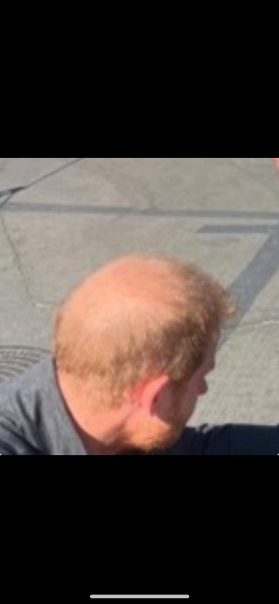 0Rthebest91033's tweet photo. #HarryWillAlwayBeNumber2 π©π€‘
#DisasterTouristsMeghanAndHarry #DonutDonAKAPrinceHarry #DisingenuousEntitledPeopleInTheWorld #DukeOfShameAndHypocrisy #StrippedTitlesAwayFromHarryAndMeghan #SussexsShitShow #ShitShowInMontecito #DimWitHarryNeeds2BeDeported #HarryYoureNotAVictimDude https://t.co/mci2jElwBt