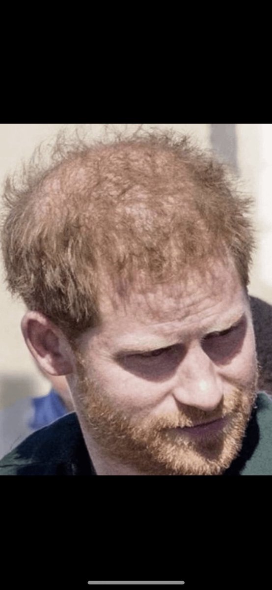0Rthebest91033's tweet photo. #MoneyMoneyMoneyPrinceHarry
#PrinceHarryIsALiarAndAFraud #PRNightmare4HarryAndMeghan #PrinceHarryIsTheOfficialFartSniffer #HumiliationOfTheHarklesContinues #AlwaysOnTheZListMeghanMarkle #StartPackingDude #StrippedTitlesAwayFromHAndM #MontecitoMoochers #HarryDidntSlayTheDragon https://t.co/GdXNXB3iQw