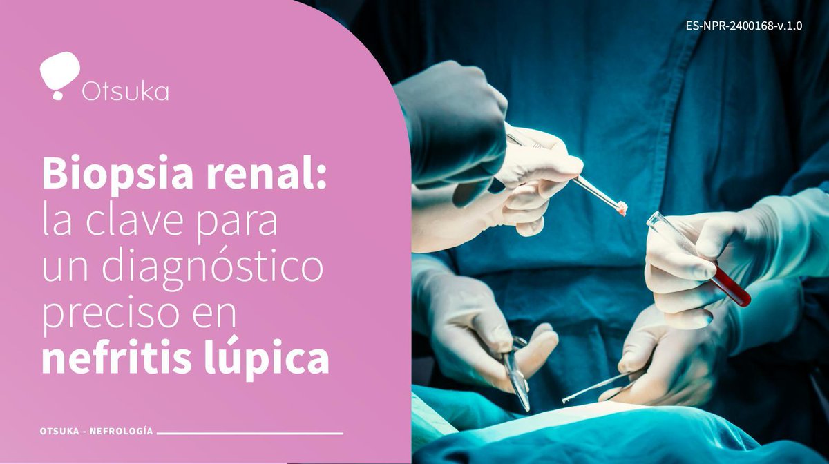 ¿Es necesaria la biopsia renal ante la sospecha de nefritis lúpica?

La biopsia renal sigue siendo clave para confirmar el diagnóstico, determinar el tipo y gravedad, y guiar el tratamiento adecuado.

¿Quieres saber más? No te pierdas la Guía para pacientes con nefritis lúpica,