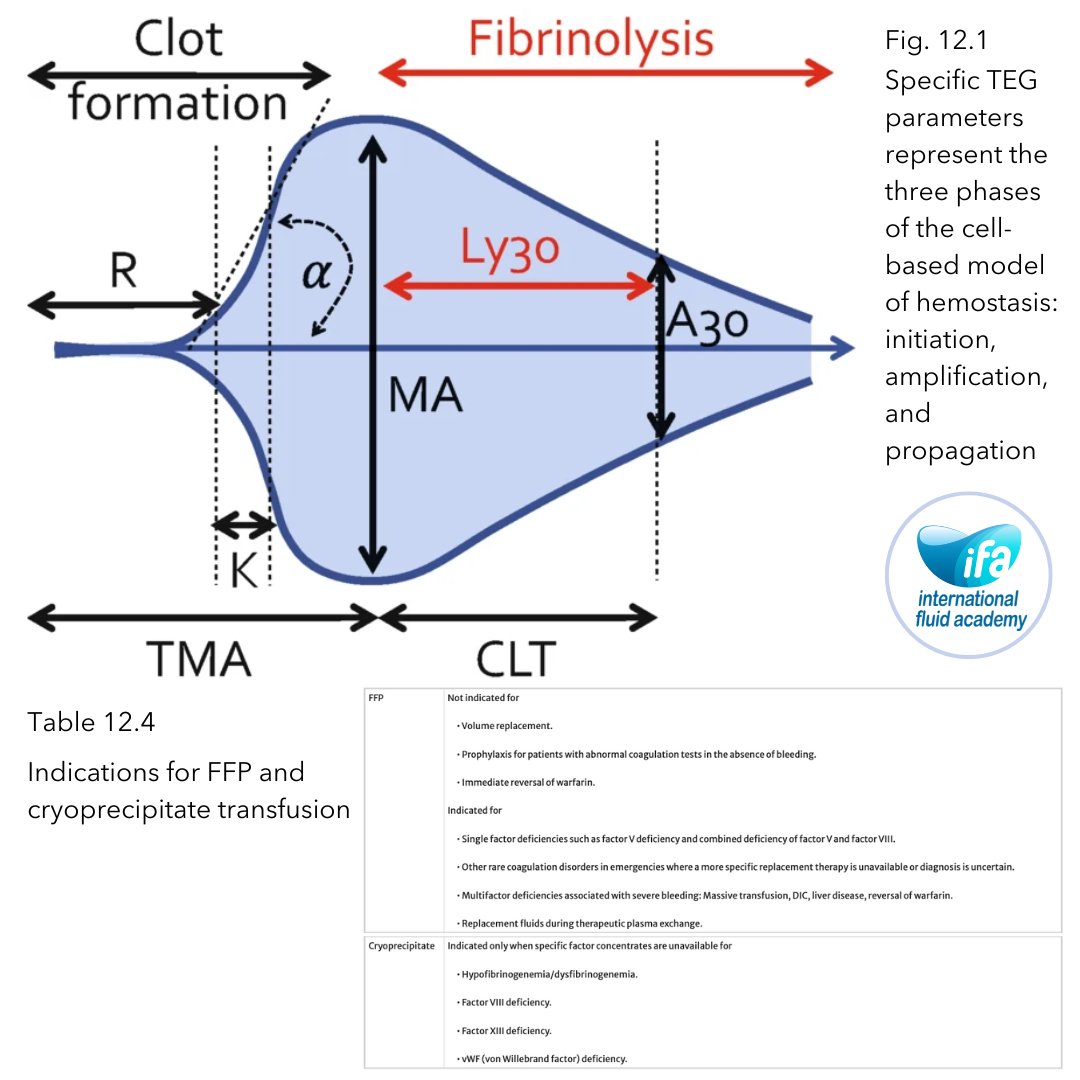 💡 How to Use Blood and Blood Products? 💡

🔹 Coagulopathy and Plasma Transfusion

Presence of coagulopathy in critical illness can increase the risk of developing hemorrhagic complications fivefold compared to patients with a normal coagulation status. To assess bleeding risk