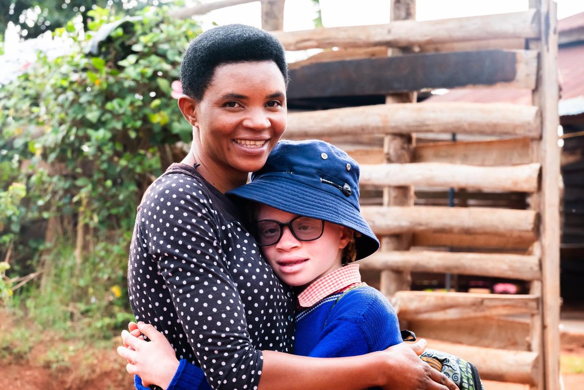 Every child deserves a childhood full of hope and opportunity. Meet Claudette, a 10-year-old from Rwanda born with albinism, whose life has been transformed by the USAID Uburezi Iwacu project. Once teased and excluded due to her visual impairment, Claudette now confidently