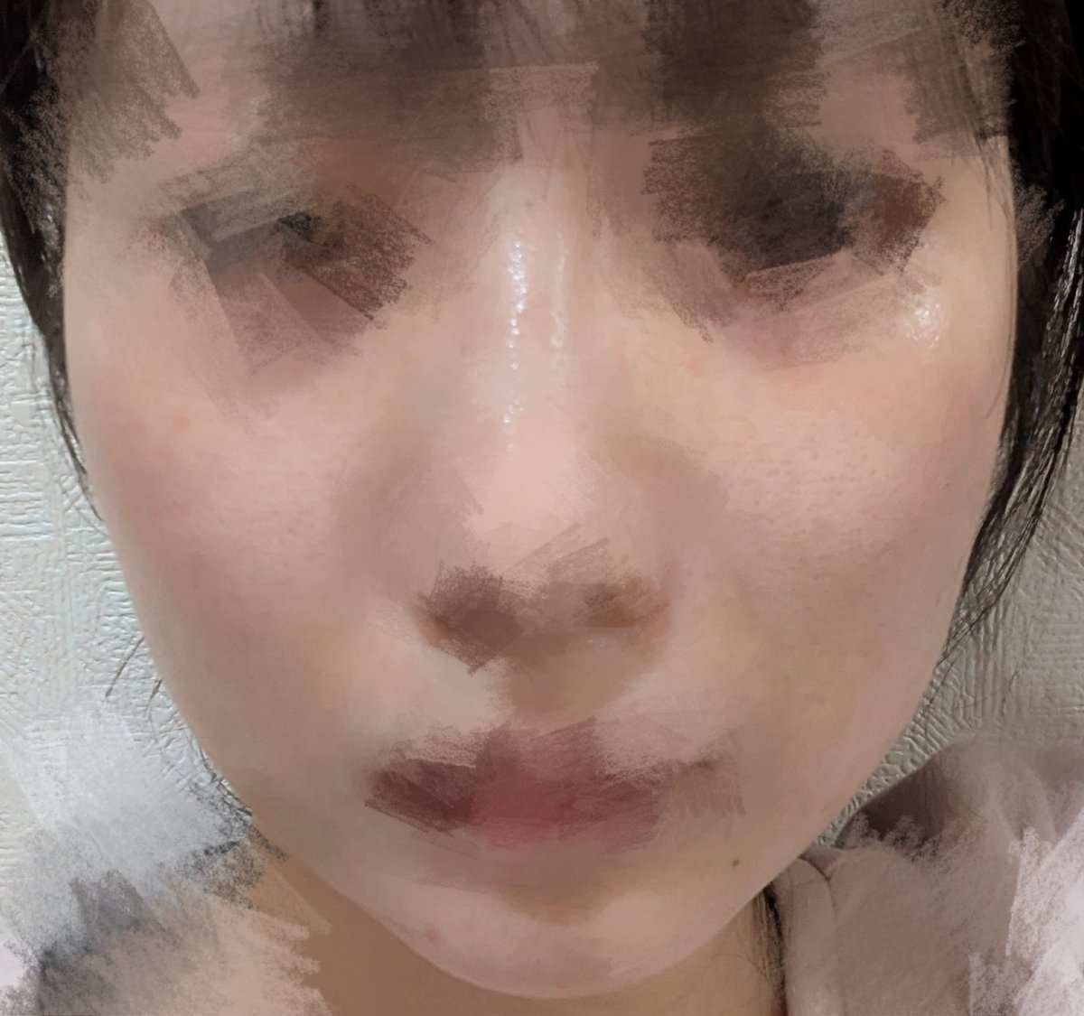 zeo0_0's tweet photo. 糸リフト12本
1枚目から
before→当日→次の日→5日目
ほうれい線もフェイスラインもあがって嬉しい🥺
ただ顔が大きく見える気がするんだけど、それでも今のが全然良いから何も問題ない😂
これで6万破格すぎる https://t.co/6f4OWlAhqR