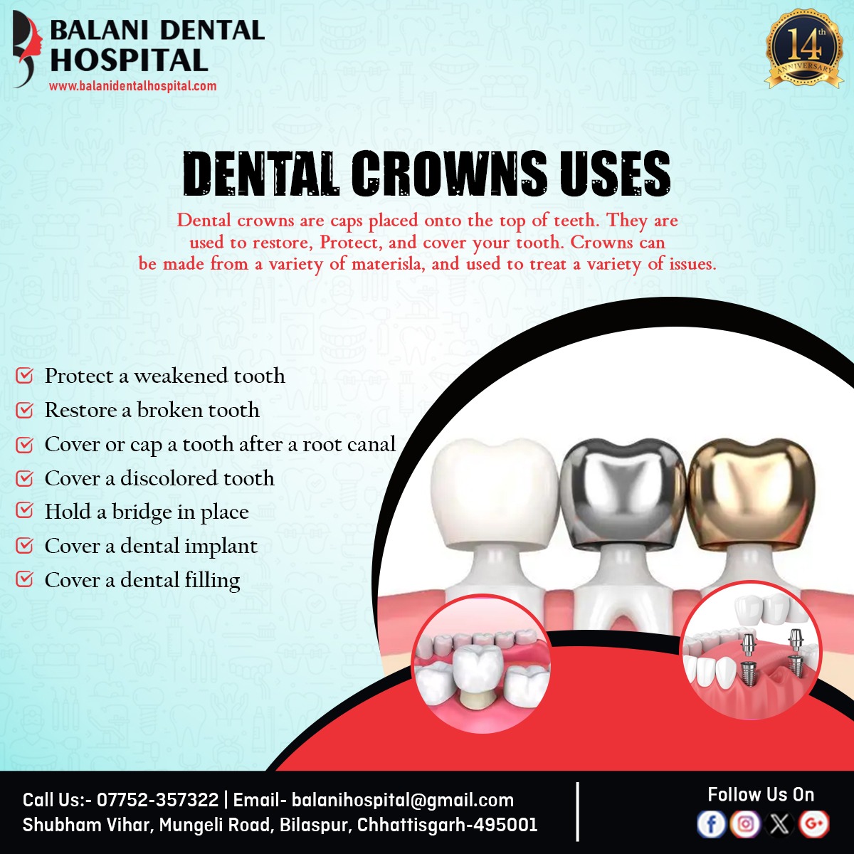 Balanidental's tweet photo. Restore, protect, and perfect your teeth with our high-quality dental crowns.

📞 07752-357322
🌐 https://t.co/bPFqFJbNHC

#DentalClinic #SmileMakeover #DentalCrowns #SmileTransformation #balanidental #bilaspur #chhattisgarh https://t.co/j8rW75akIY