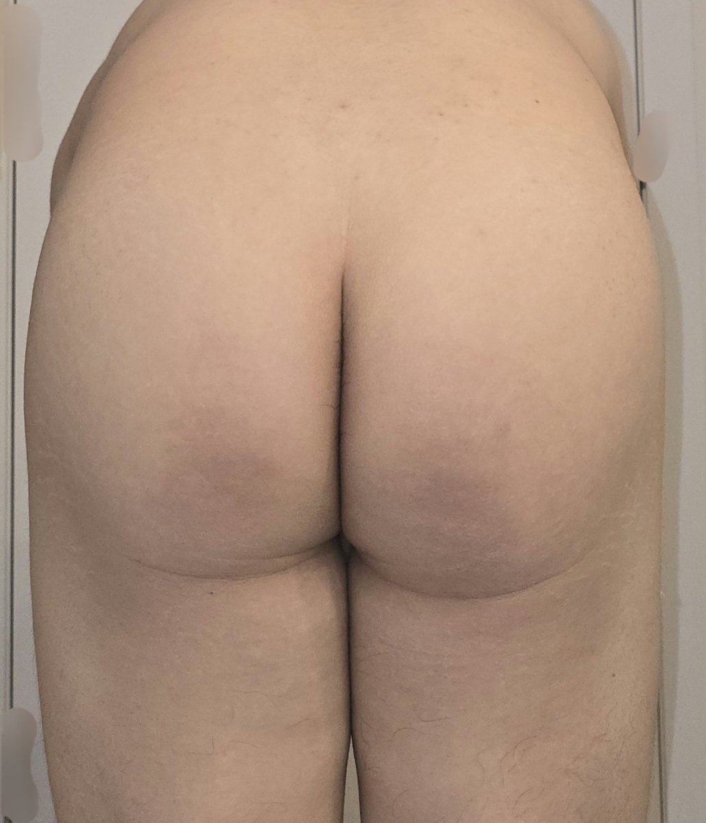 터지기 전 깨끗한 궁뎅이

#엉덩이체벌 #스팽킹 #멜키 #spankee #spaking #butt #ass #paddle #cane #하드스팽