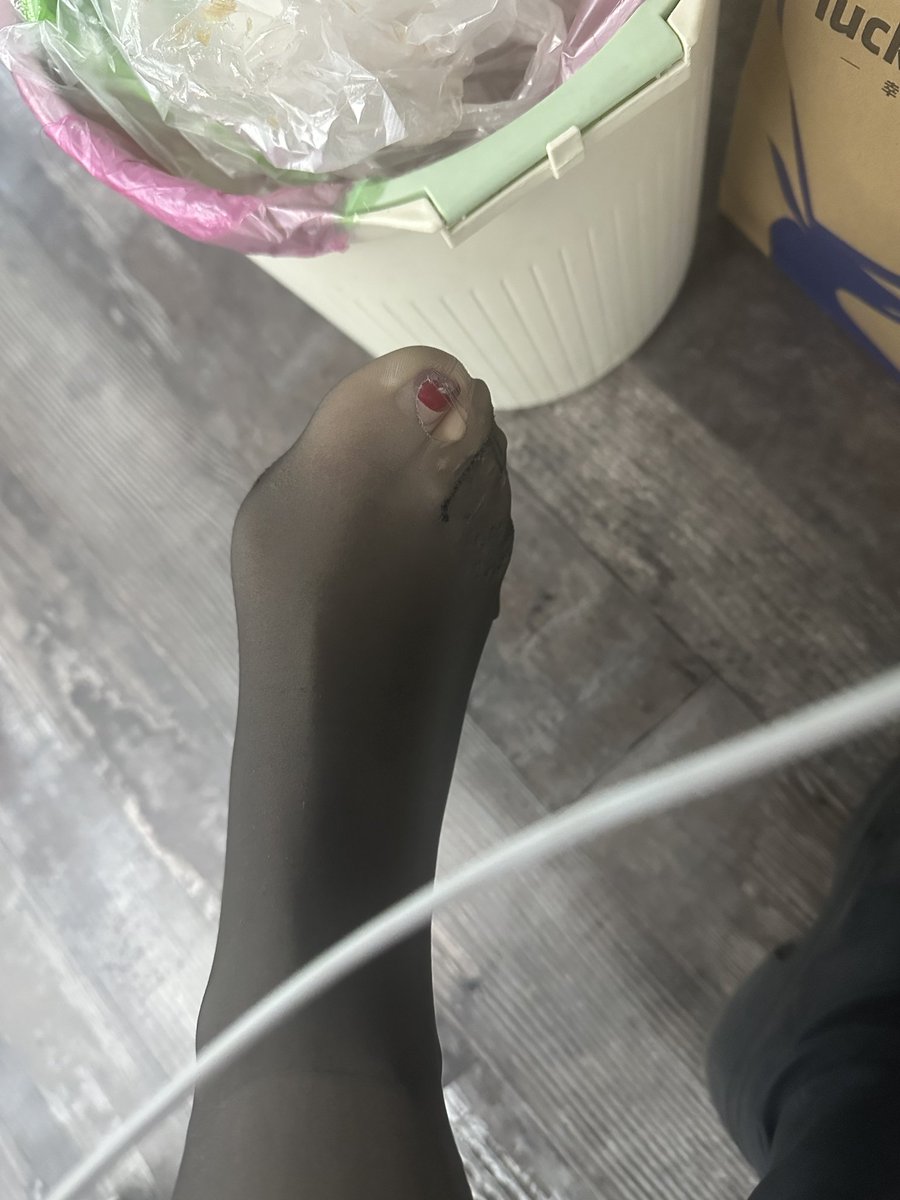 所有的光腿神器都逃不过这一刻
冬天丝袜的袜子底 冰冰凉凉
穿的第二次就会破
越来越破 不管我怎么修
然后穿一天脚趾头痛死！！！ https://t.co/rPR7bCXVES