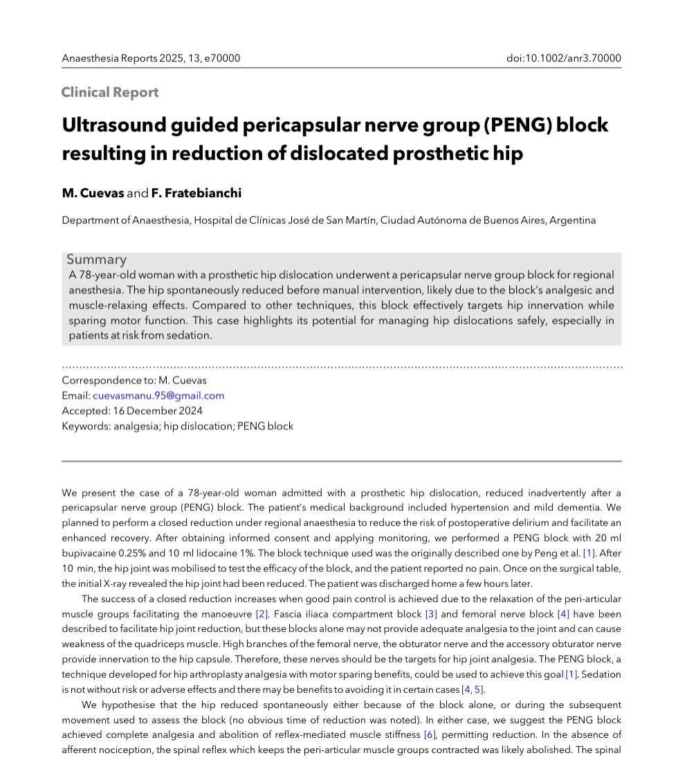 Anaes_Reports's tweet image. What do you think of this use of the PENG block? 

Anyone else had a dislocation spontaneously relocate when decent analgesia was provided? 

buff.ly/3DRtooM

@DrPhilipPeng @BlockIt_Hot_Pod
#freeforaweek #anaesthesia #regional #foamed #MedTwitter #anesthesia