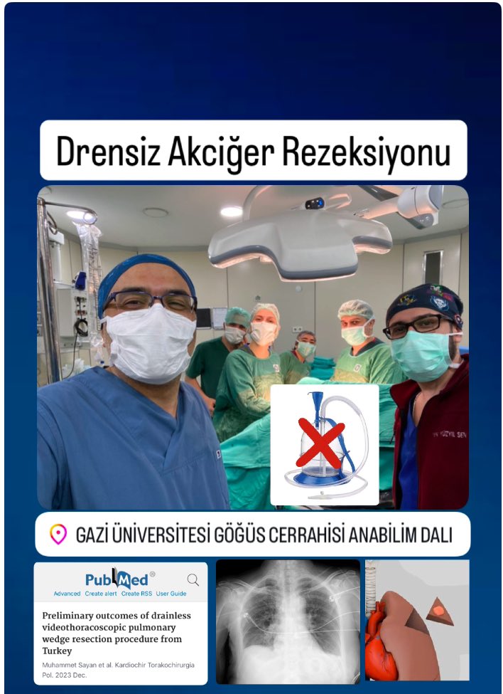 drsayann's tweet photo. Göğüs tüpü konulmadan yapılan akciğer ameliyatları, hastalara ameliyat sonrası dönemde birçok avantaj sunmaktadır. Yurtdışında ileri merkezlerde uygulanan bu yöntemi, merkezimizde de 2022 yılından beri uygulamaktayız ve sonuçlarımızı literatüre kazandırdık. @Gazi_Universite https://t.co/3eKDFYZn4W