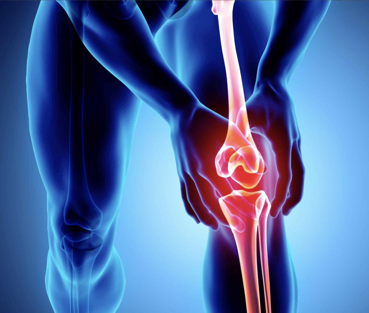 The worst thing you can do for your knee pain is just rest, ice, pain-killers and do absolutely nothing. 

If you want to recover quicker from knee injury then stop just resting and icing...

Here's 6 things you can do instead 🦿▶️🦵 🧵