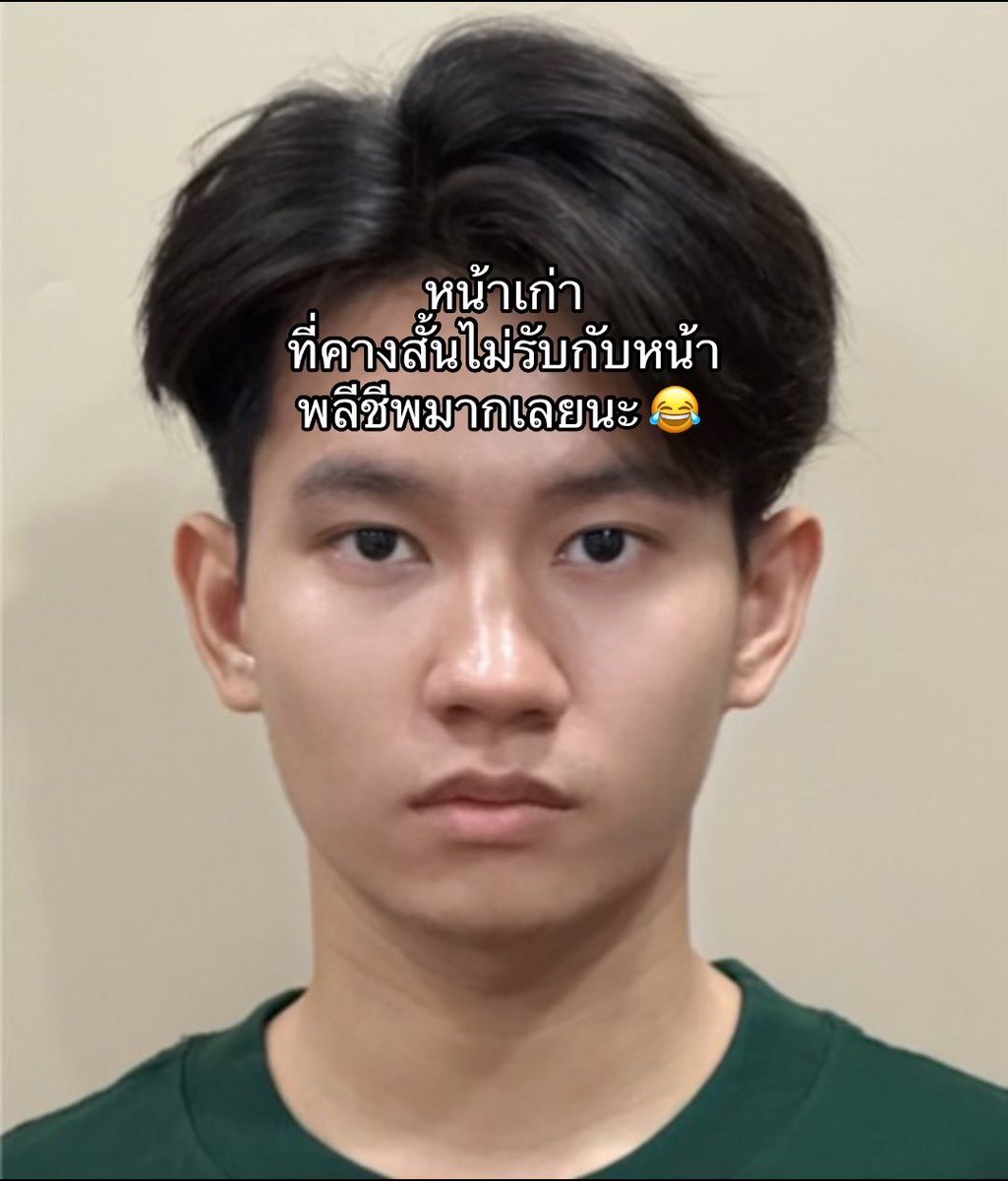 huiithananat's tweet photo. รีวิวทำคาง ที่รู้งี้ทำนานละ 😂 #ศัลยกรรม #วินเซนต์คลินิค https://t.co/fPaJky3Emq