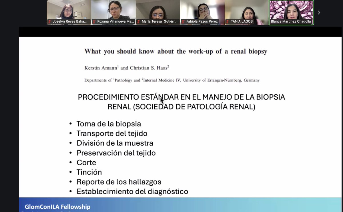 jopelina's tweet photo. Patología Renal BootCamp con @kidneypathology @bmc_nefropato #DraMontero @DraSumire #womeninrenalpathology 🙋🏻♀️👑 Casas #Podocitos #Complemento #Semilunas #Depositos @GlomConILA @GlomCon https://t.co/OUdktef5Ju